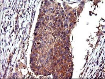 Immunohistochemistry: CEP68 Antibody (OTI5B4) [NBP2-46252]