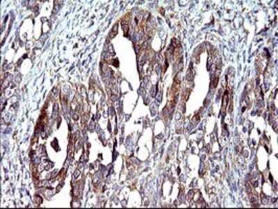 Immunohistochemistry: CEP68 Antibody (OTI5B4) [NBP2-46252]