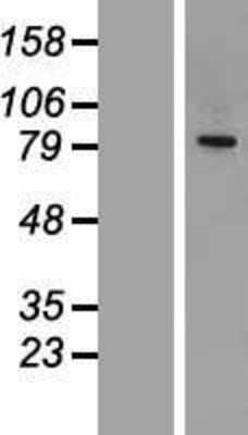 Western Blot: CEP68 Overexpression Lysate [NBL1-09103]