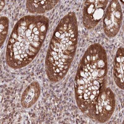 Immunohistochemistry-Paraffin: CEP70 Antibody [NBP1-88593]