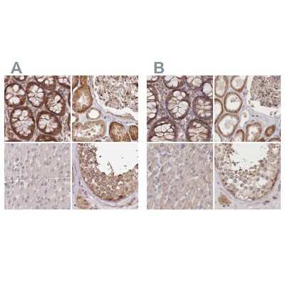 Immunohistochemistry-Paraffin: CEP70 Antibody [NBP1-88593]