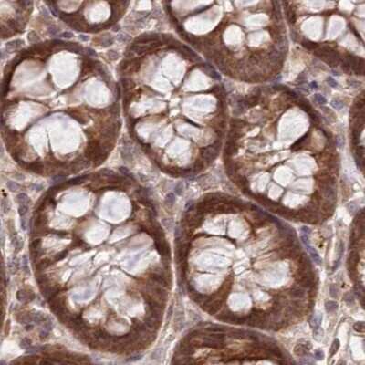 Immunohistochemistry-Paraffin: CEP70 Antibody [NBP1-88593]