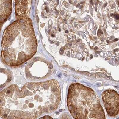 Immunohistochemistry-Paraffin: CEP70 Antibody [NBP1-88593]
