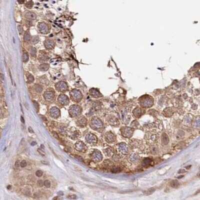 Immunohistochemistry-Paraffin: CEP70 Antibody [NBP1-88593]