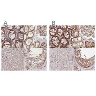 Immunohistochemistry-Paraffin: CEP70 Antibody [NBP1-88594]