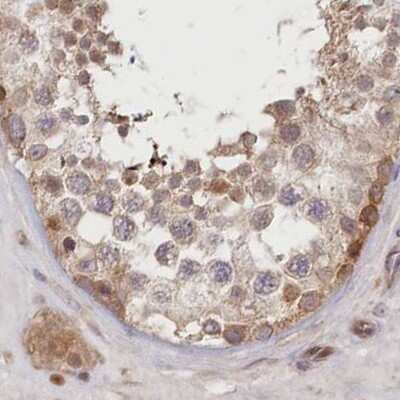 Immunohistochemistry-Paraffin: CEP70 Antibody [NBP1-88594]