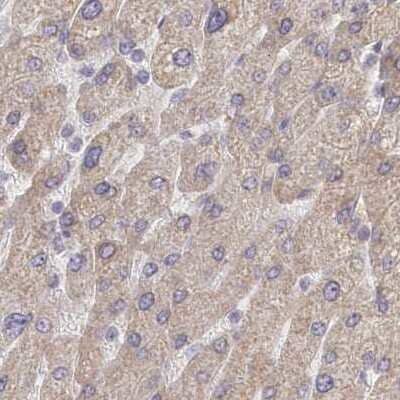 Immunohistochemistry-Paraffin: CEP70 Antibody [NBP1-88594]