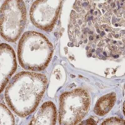 Immunohistochemistry-Paraffin: CEP70 Antibody [NBP1-88594]