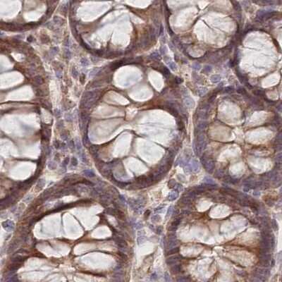 Immunohistochemistry-Paraffin: CEP70 Antibody [NBP1-88594]