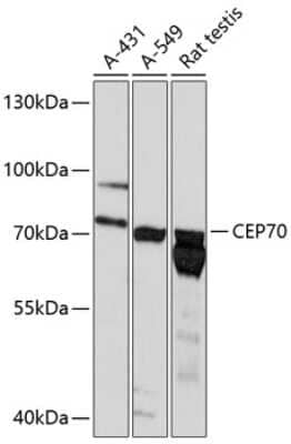 Western Blot: CEP70 AntibodyAzide and BSA Free [NBP2-92135]