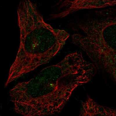 Immunocytochemistry/ Immunofluorescence: CEP72 Antibody [NBP2-57811]