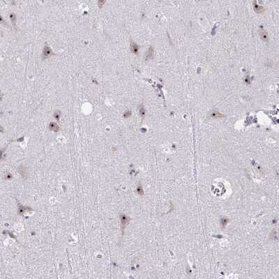 Immunohistochemistry-Paraffin: CEP72 Antibody [NBP2-34103]