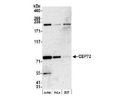 Western Blot: CEP72 Antibody [NB100-60661]