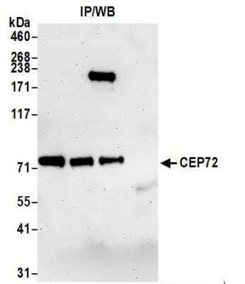 Western Blot: CEP72 Antibody [NB100-60661]