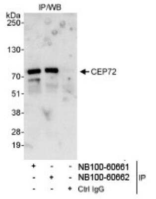 Western Blot: CEP72 Antibody [NB100-60662]