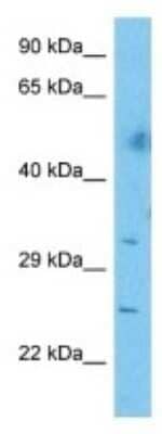 Western Blot: CEP72 Antibody [NBP3-10639]