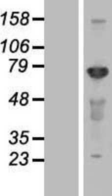 Western Blot: CEP72 Overexpression Lysate [NBL1-09105]