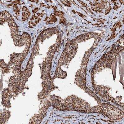 Immunohistochemistry: CEP76 Antibody [NBP1-88472]