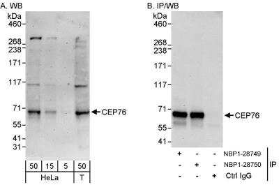 Western Blot: CEP76 Antibody [NBP1-28749]