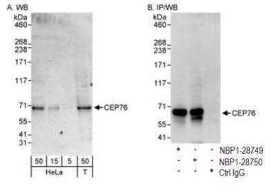 Western Blot: CEP76 Antibody [NBP1-28750]