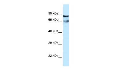 Western Blot: CEP76 Antibody [NBP2-87173]