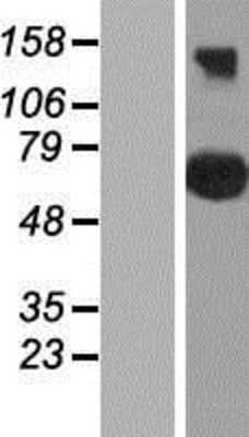 Western Blot: CEP76 Overexpression Lysate [NBP2-06270]