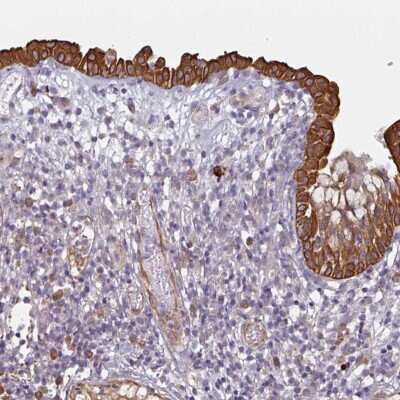 Immunohistochemistry-Paraffin: CEP78 Antibody [NBP2-48920]