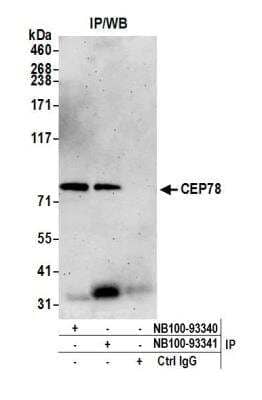 Immunoprecipitation: CEP78 Antibody [NB100-93341]