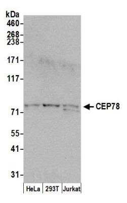 Western Blot: CEP78 Antibody [NB100-93341]