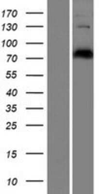 Western Blot: CEP78 Overexpression Lysate [NBP2-06065]