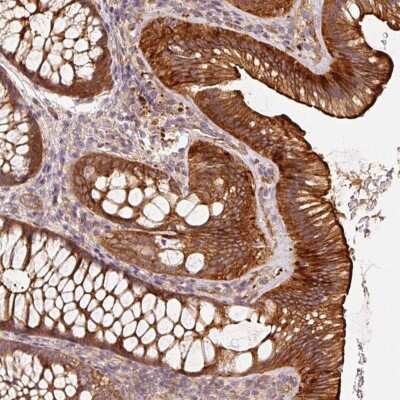 Immunohistochemistry: CEP95 Antibody [NBP2-49042]