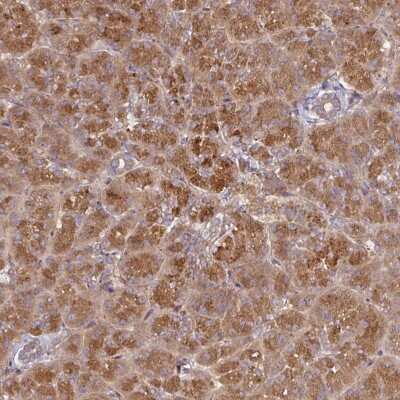 Immunohistochemistry: CEP95 Antibody [NBP2-49043]