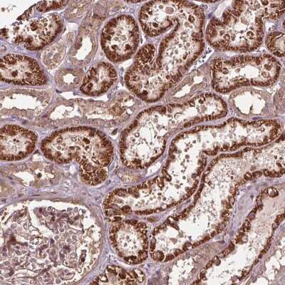 Immunohistochemistry: CEP95 Antibody [NBP2-49329]