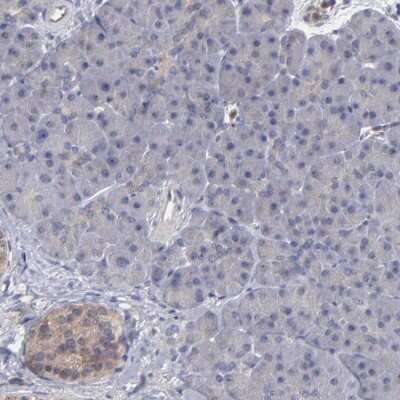 Immunohistochemistry-Paraffin: CEP97 Antibody [NBP1-83591]