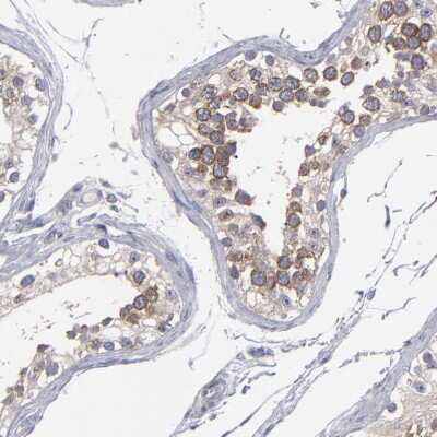 Immunohistochemistry-Paraffin: CEP97 Antibody [NBP1-83591]