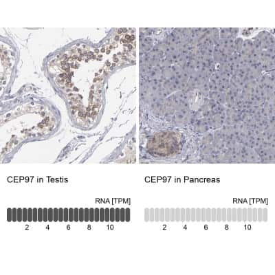 Immunohistochemistry-Paraffin: CEP97 Antibody [NBP1-83591]