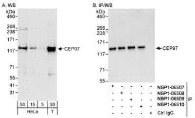 Western Blot: CEP97 Antibody [NBP1-06507]