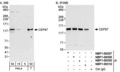 Western Blot: CEP97 Antibody [NBP1-06508]