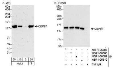 Western Blot: CEP97 Antibody [NBP1-06510]