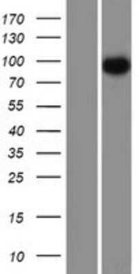 Western Blot: CEP97 Overexpression Lysate [NBP2-06321]