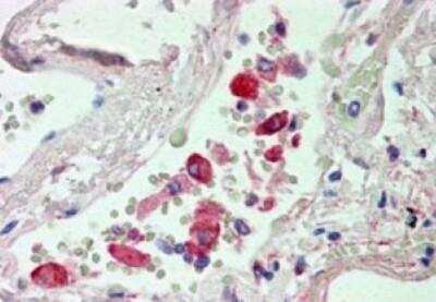 Immunohistochemistry-Paraffin: Carboxylesterase 1/CES1 Antibody [NBP1-00167]