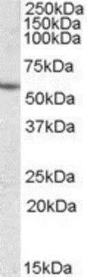 Western Blot: Carboxylesterase 1/CES1 Antibody [NBP1-00167]