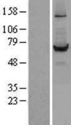 Western Blot: Carboxylesterase 1/CES1 Overexpression Lysate [NBL1-09112]