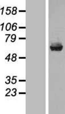 Western Blot: Carboxylesterase 1/CES1 Overexpression Lysate [NBL1-09113]