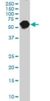 Western Blot: Carboxylesterase 2/CES2 Antibody (4E3) [H00008824-M03]