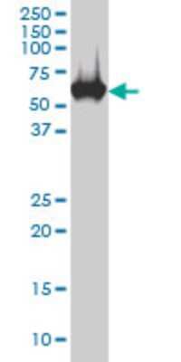 Western Blot: Carboxylesterase 2/CES2 Antibody (4F12) [H00008824-M02]