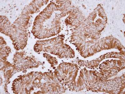 Immunohistochemistry-Paraffin: Carboxylesterase 2/CES2 Antibody [NBP2-15864]