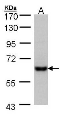 Western Blot: Carboxylesterase 2/CES2 Antibody [NBP1-32653]