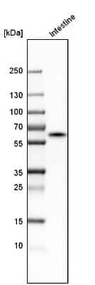 Western Blot: Carboxylesterase 2/CES2 Antibody [NBP1-84556]