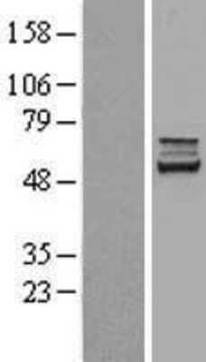 Western Blot: Carboxylesterase 2/CES2 Overexpression Lysate [NBL1-09114]